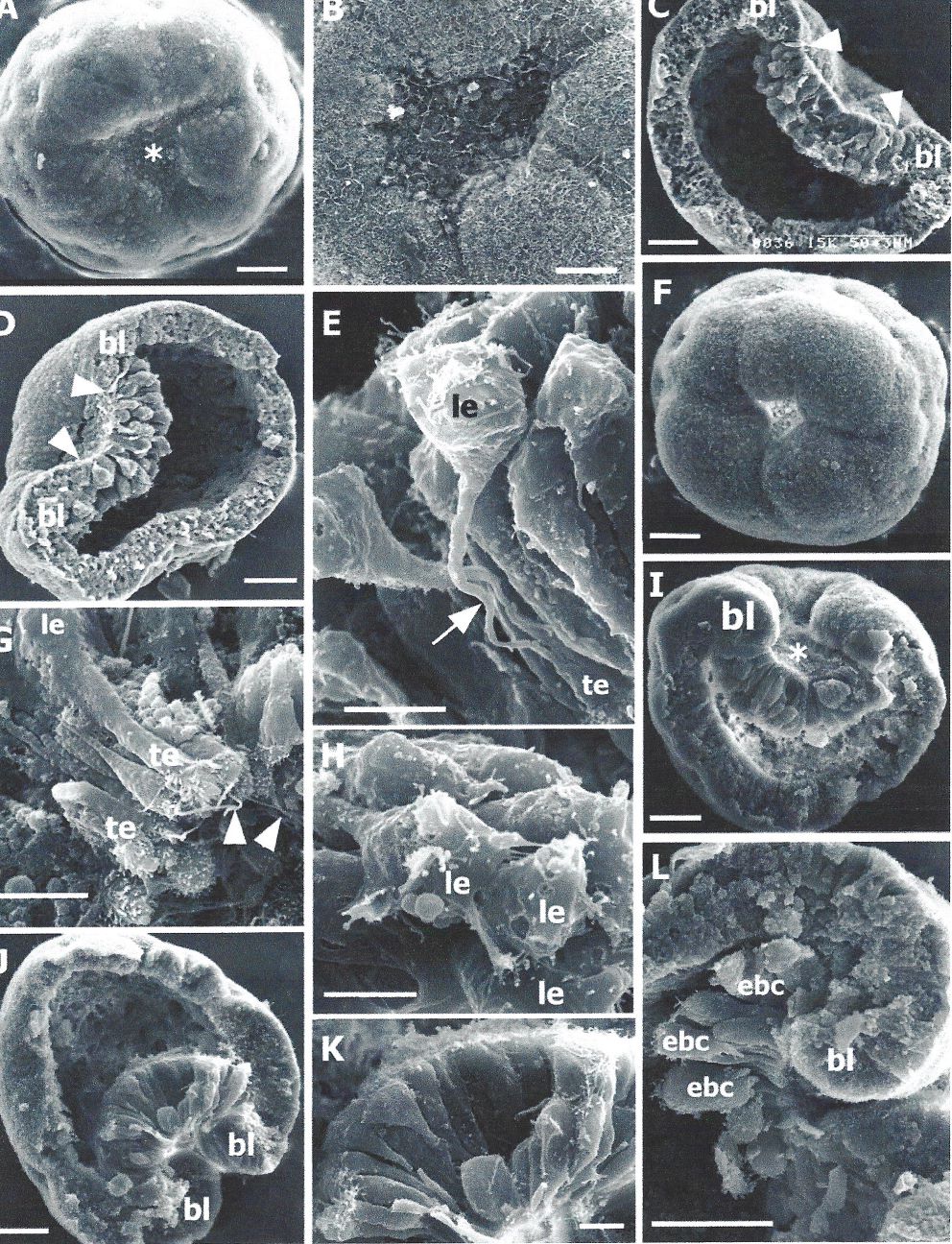 sea anemone gastrulation - Moscow State University - 2